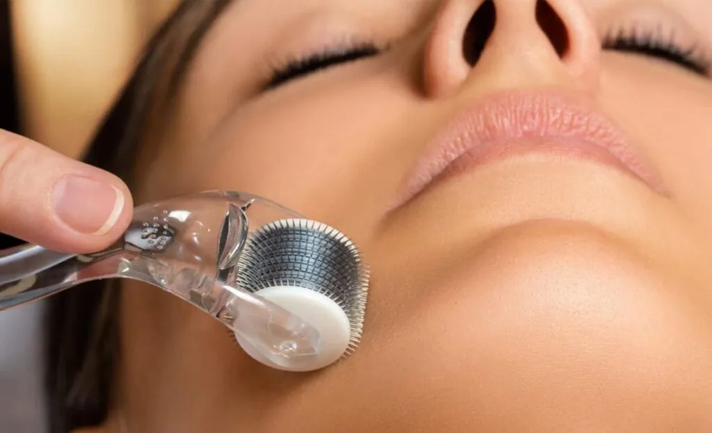 Microneedling-Gesichtsbehandlung